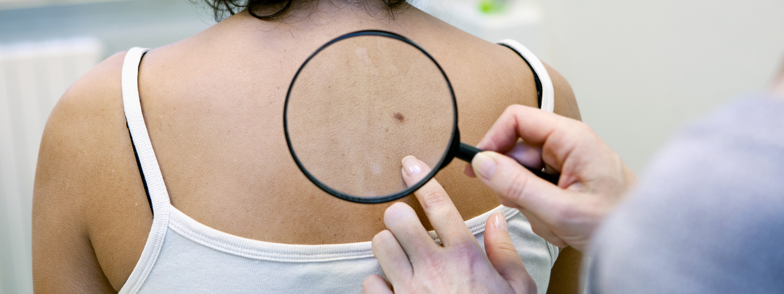 A Woman having check up on skin cancer