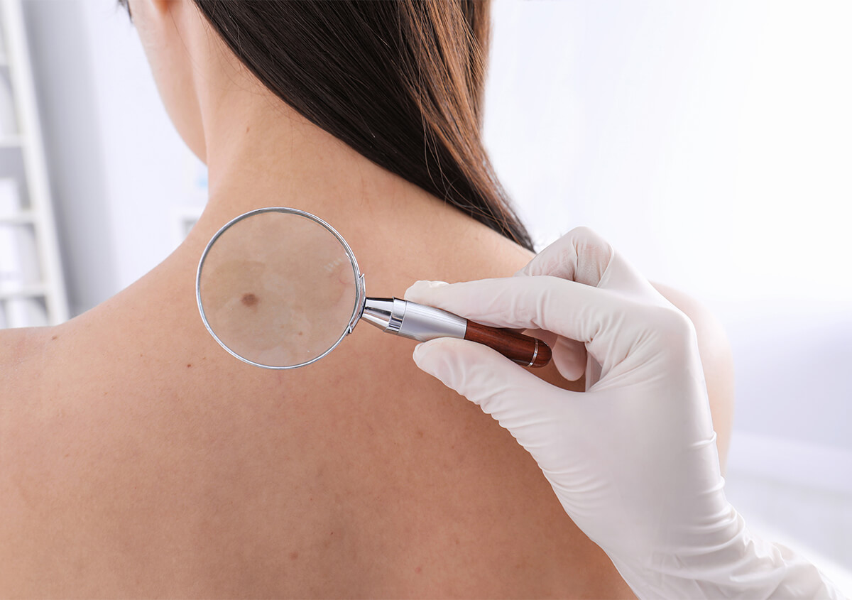 Dermatologist in Orchard Park explains everything you need to know about skin cancer